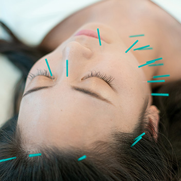 THE23大阪梅田 美容鍼